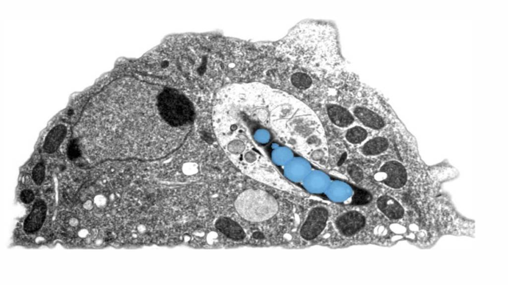 Elektronenmikroskopische Aufnahme einer Amöbe, die mit dem Tuberkulose-Erreger (blau) infiziert ist.
