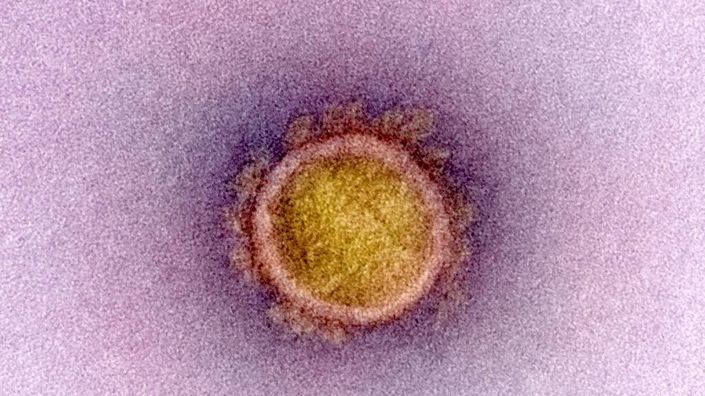 Das neuartige Coronavirus ist einer Studie zufolge auch noch nach Stunden auf Oberflächen auffindbar. (Symbolbild)