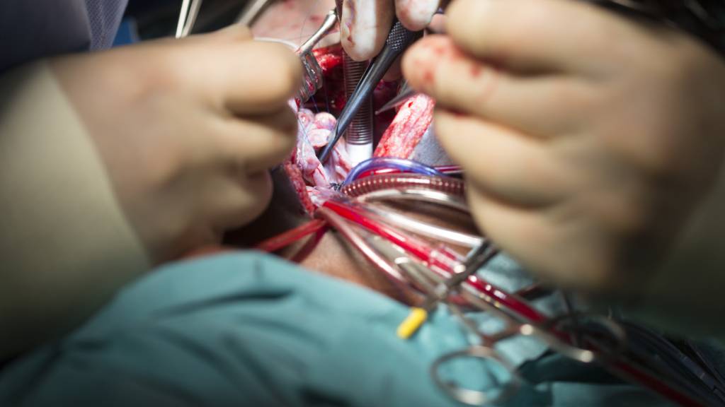 Pascal Meier hätte Chefarzt der Kardiologie werden sollen am Kantonsspital Aarau. Wegen öffentlicher Kritik tritt er seine Stelle nun nicht an. (Symbolbild)