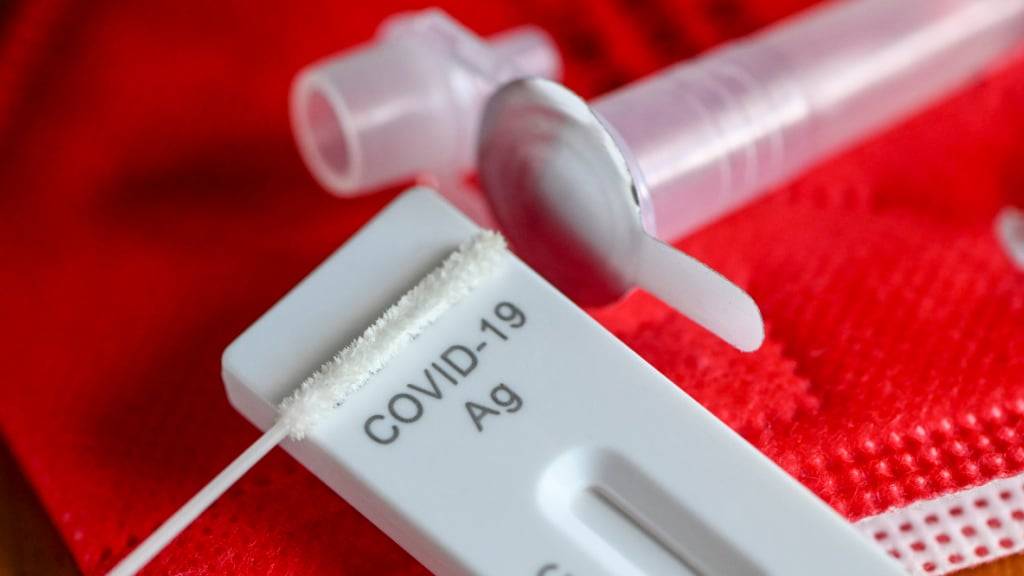 Der neue Pandemieplan nimmt die Erfahrungen von Covid-19 auf: Testset für das Coronavirus. (Archivbild)
