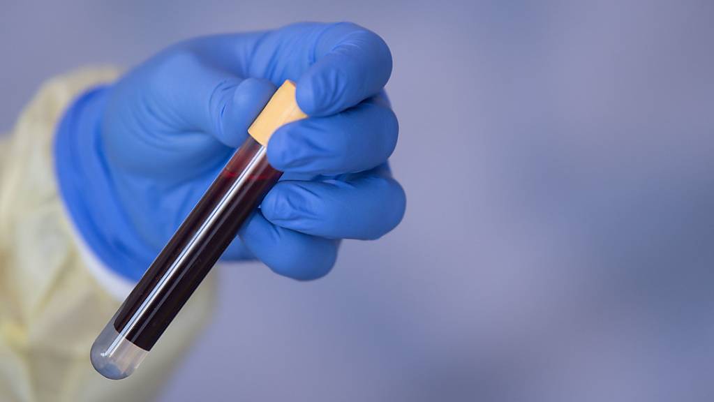 Ein Mitarbeiterin des Robert Koch-Instituts (RKI) hält eine Blutprobe für einen Antikörpertest in der Hand.