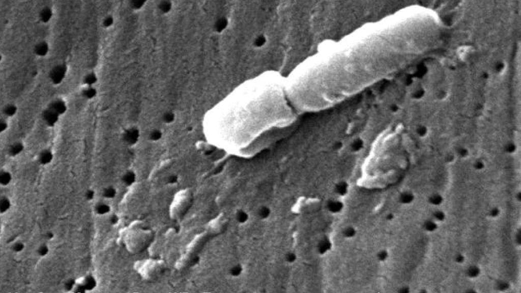 Elektronenmikroskopische Aufnahme des Bakteriums Klebsiella pneumoniae