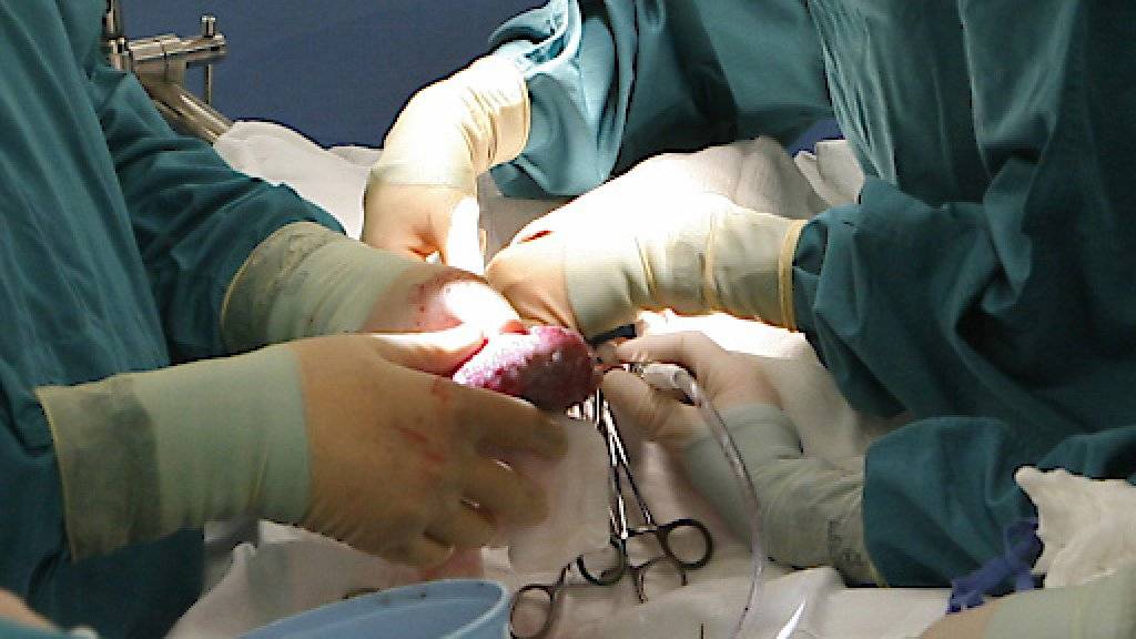 Die Transplantation einer Niere. In der Schweiz warten derzeit über 1500 Menschen auf eine Organspende. Jedes Jahr sterben etwa hundert Menschen, weil sie nicht mehr rechtzeitig ein Spenderorgan erhalten. (Archivbild)