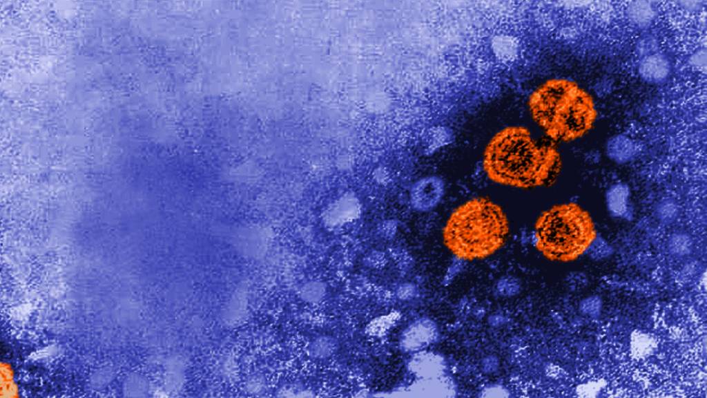 Hepatitis-B-Viren (rot) in einer Elektronenmikroskop-Aufnahme. (Archivbild)