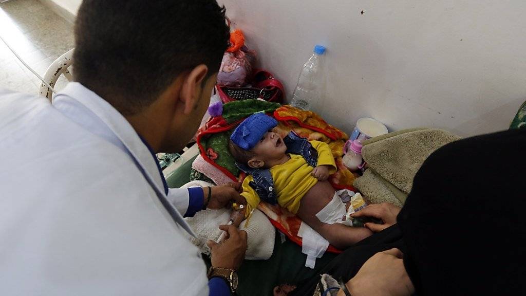 Ein Arzt behandelt ein ein unterernährtes Kind im Jemen. Hilfsorganisation fordern eine sofortige Aufhebung der Blockade des Landes, da sonst Millionen Menschen vom Tod bedroht seien. (Archiv)