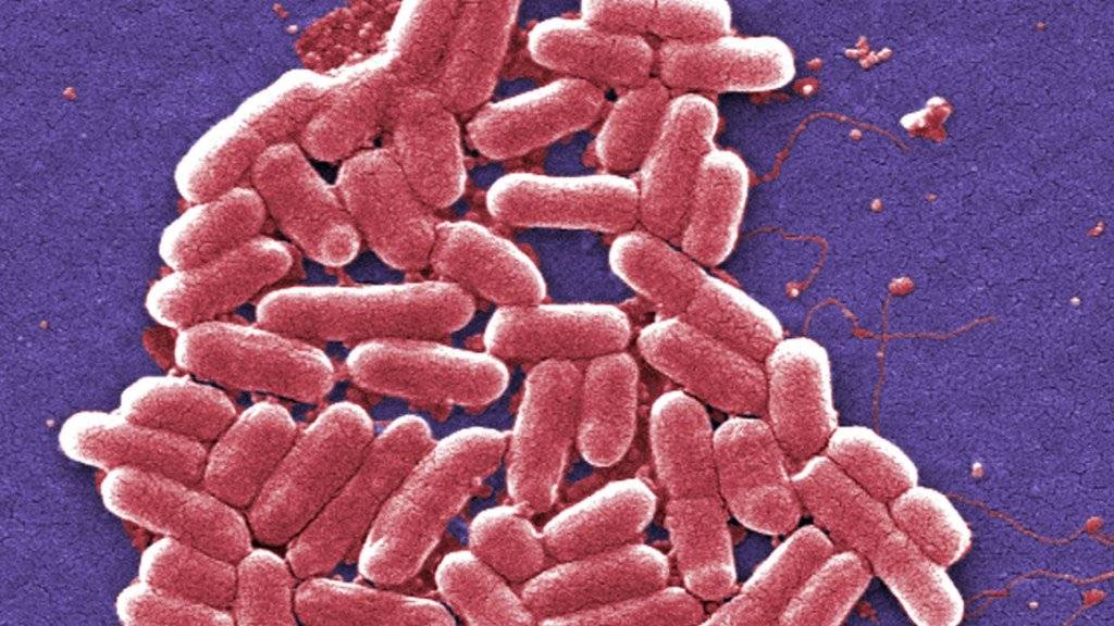 Antibiotika-Resistenzen von Keimen gefährden laut der Weltgesundheitsorganisation (WHO) den medizinischen Fortschritt. (Archivbild)