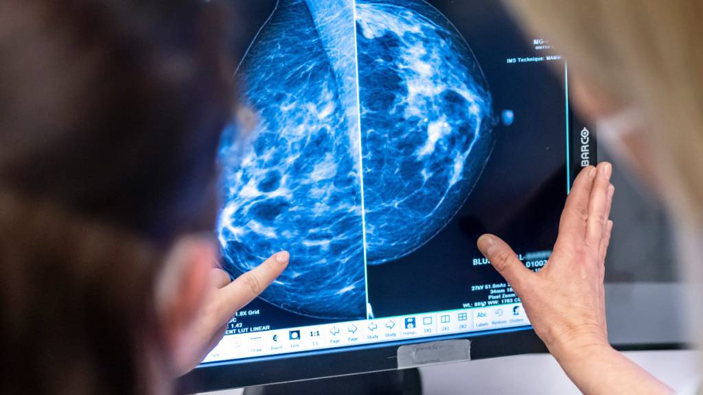 Der Schaffhauser Regierungsrat will so rasch wie möglich ein Brustkrebs-Früherkennungsprogramm einführen. (Symbolbild)