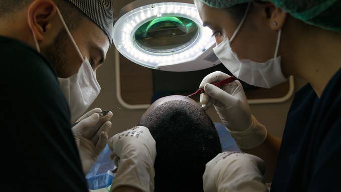 Zwei Frauen stehen wegen Pfusch bei Haartransplantationen in Zürich vor Gericht