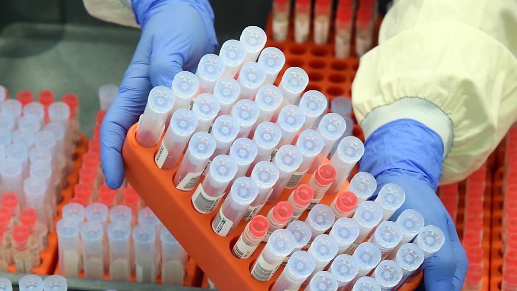 Kantone müssen Hunderttausende PCR-Speicheltests austauschen