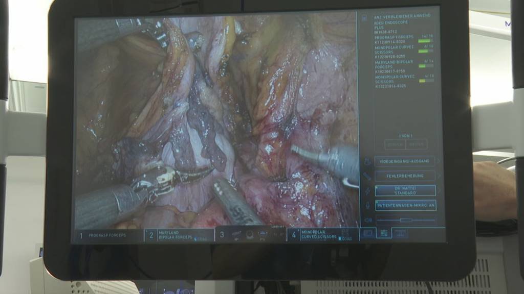 Roboter operiert neu am Luzerner Kantonsspital