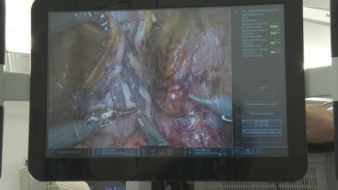 Roboter operiert neu am Luzerner Kantonsspital