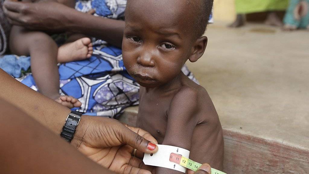 Ein unterernährtes Kind wird in einem Flüchtlingslager medizinisch untersucht. Im Nordosten Nigerias haben die andauernden Angriffe der Terrormiliz Boko Haram eine schwere Hungerkrise ausgelöst. (Archiv)