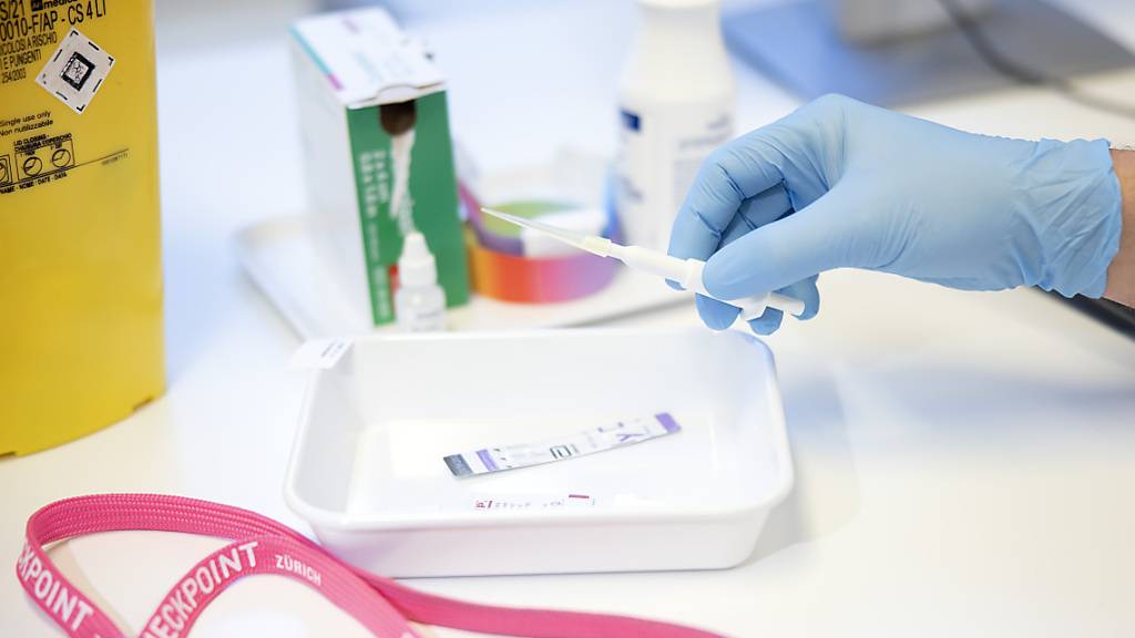 Zürich führt gratis Test-Angebot für Chlamydien und Co. ein