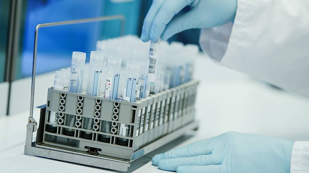Ein Mitarbeiter hält in einem Coronatest-Labor PCR-Teströhrchen in den Händen. Foto: Uwe Anspach/dpa