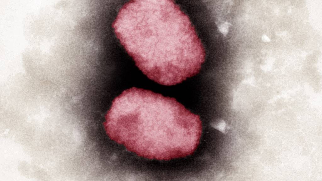 Das Affenpocken-Virus in einer elektronenmikroskopischen Aufnahme. Im Kanton Zürich wurde das Virus mittlerweile bei über 100 Personen festgestellt. (Archivbild)