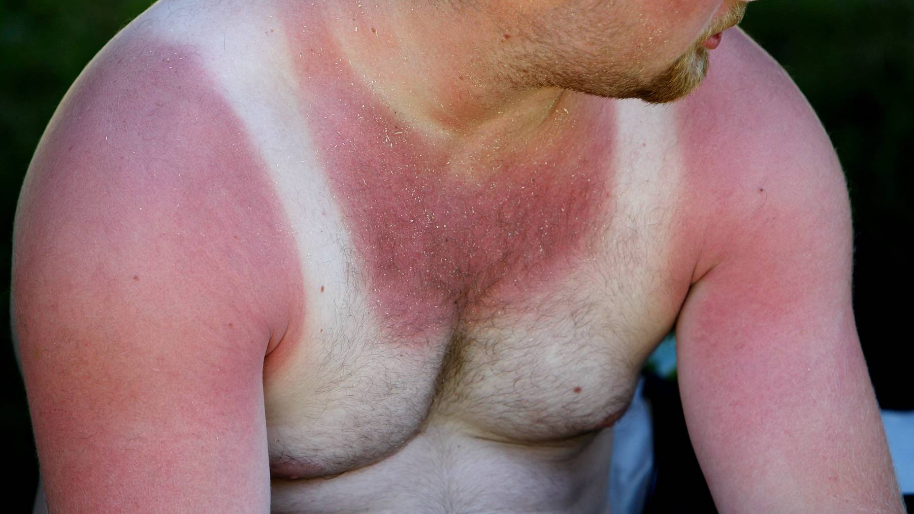 Wie Du Ein Bisschen Braune Bekommst Auch Wenn Du Helle Haut Hast Pilatustoday