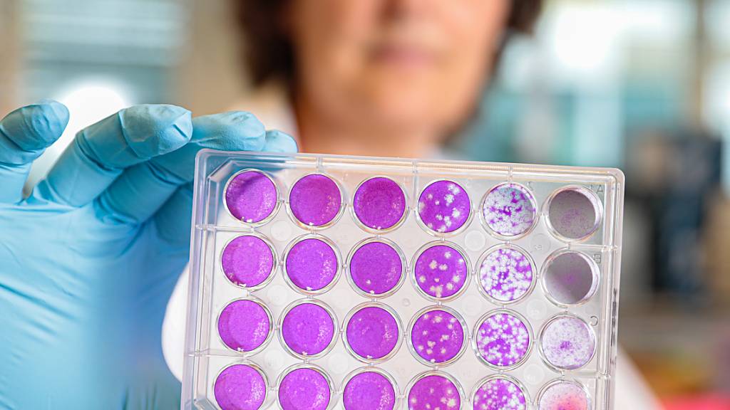 Ein neuer Antikörper-Test erfasst binnen weniger Stunden, ob die nach einer Coronavirus-Infektion gebildeten Antikörper auch neue Varianten neutralisieren können. (Pressebild)