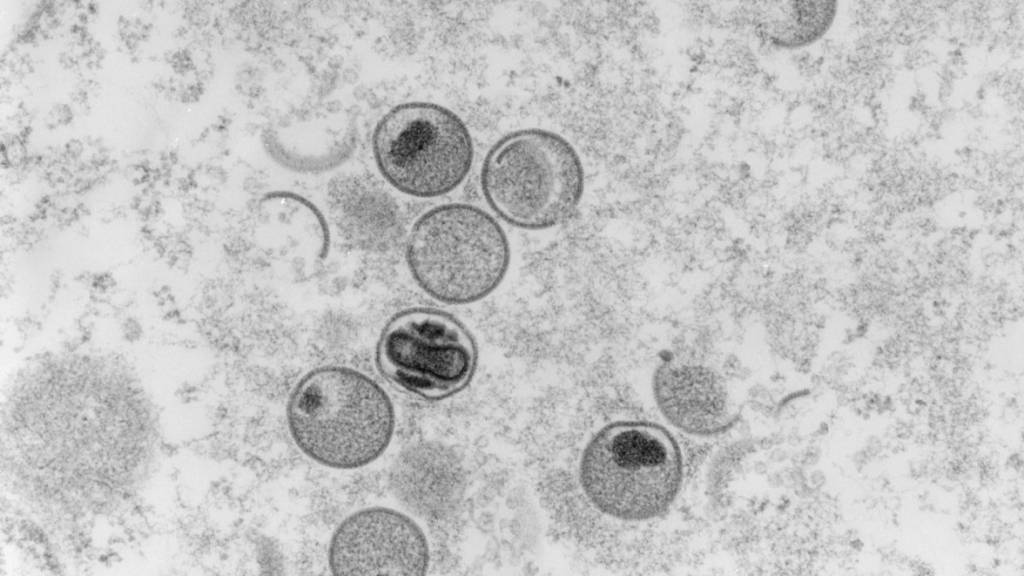 Elektronenmikroskopische Aufnahme von Affenpocken-Viren. Im Kanton Bern ist bei einer angestellten Person in einer Kita das Virus festgestellt worden. (Symbolbild