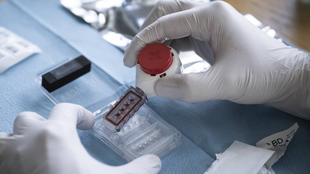 Sollte eine Person dem Doping-Statut von Swiss Olympic unterstellt sein, droht ein Disziplinarverfahren bis hin zu einer Sperre. (Archivbild)