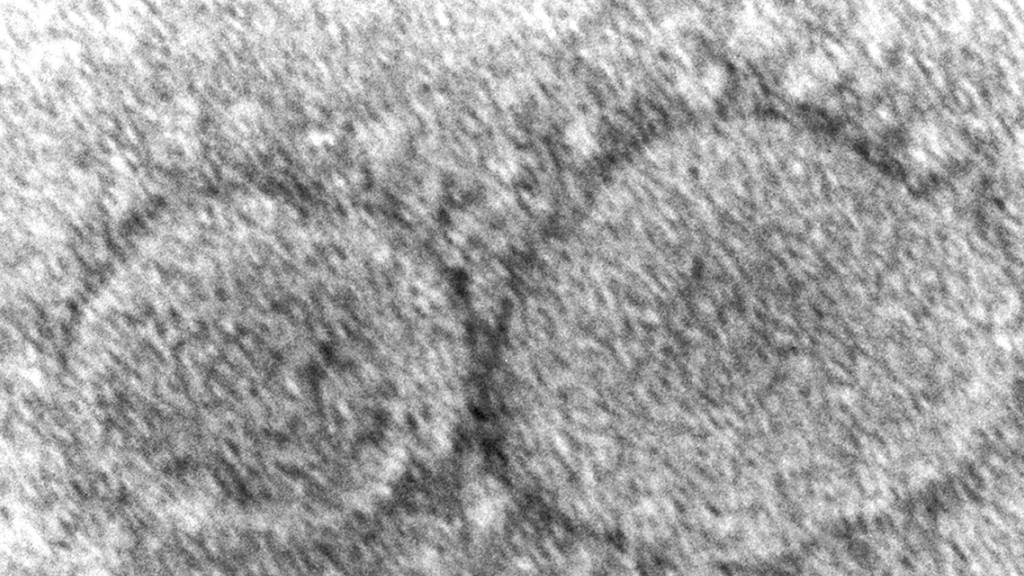 Ein Elektronenmikroskop-Bild von Sars-CoV-2: Eine neue Studie zeigt, dass sich das neue Coronavirus besonders effizient bei Temperaturen vermehrt, wie sie in den oberen Atemwegen herrschen. (Archivbild)