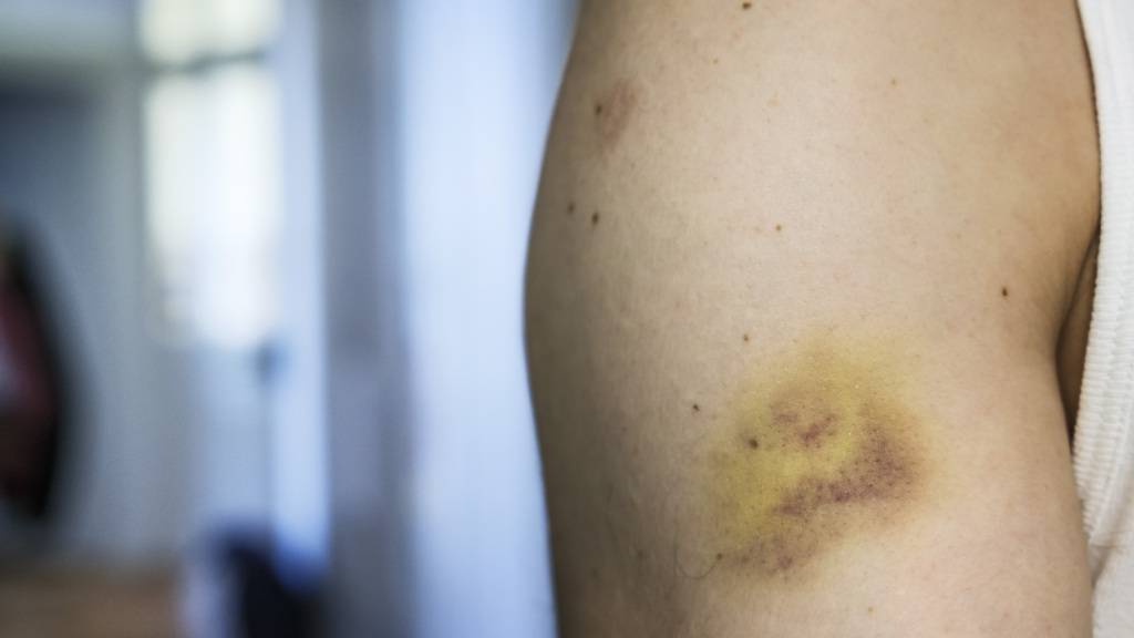 Kanton Luzern will «Forensic Nurses» einführen | Radio Central