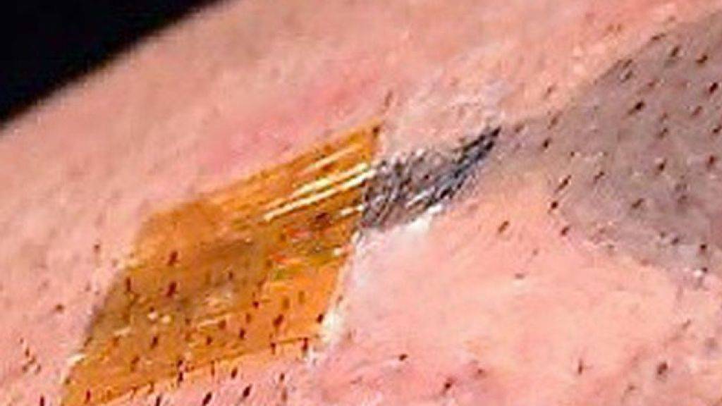 Forscher aus Österreich und Italien haben eine Tattoo-Elektrode entwickelt, die bequem ist und erst noch schnell und günstig herzustellen, nämlich im Tintenstrahldrucker. (Pressebild)