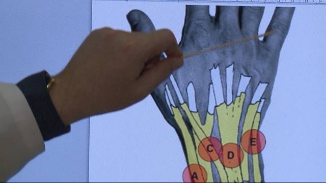 Handys verursachen Entzündungen