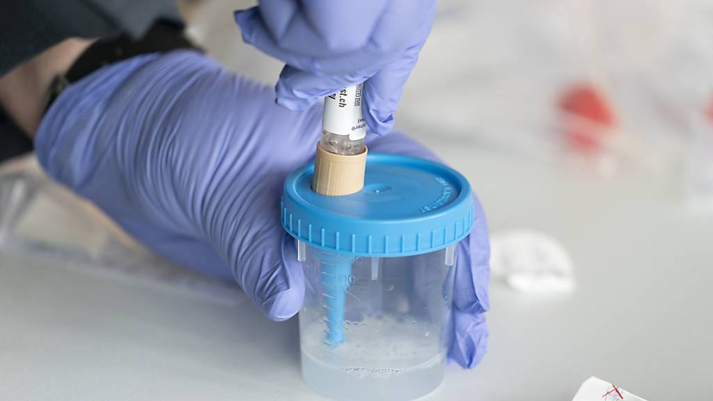 BAG meldet 44'842 neue Coronavirus-Fälle innerhalb von 24 Stunden