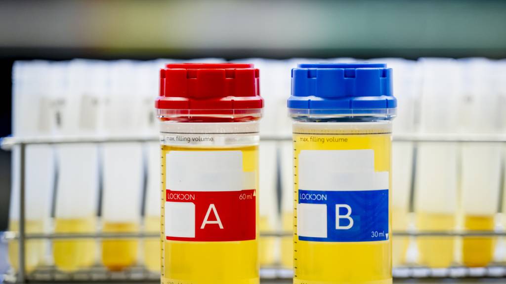 Die A- und B-Probe. In der Regel wird nur die A-Probe untersucht