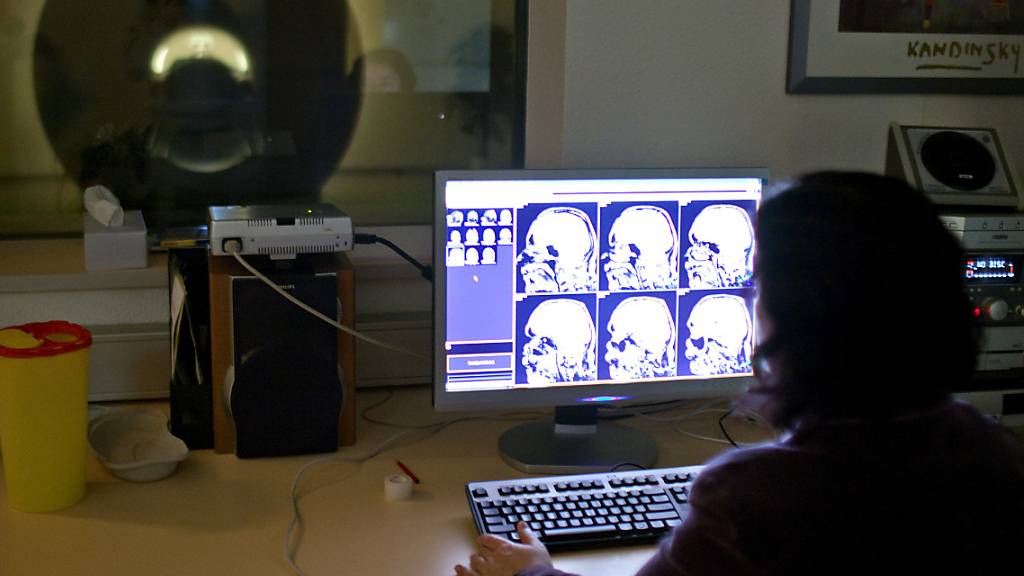 Mit Hirnscans lassen sich krankhafte Veränderungen im Gehirn erkennen: ein Proband liegt im Universitätsspital Zürich in einem Kernspintomographen. (Archivbild)