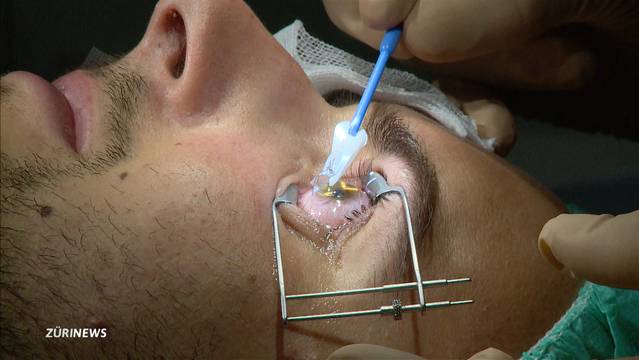 Augenlasern: Qualität trotzt Spottpreis?