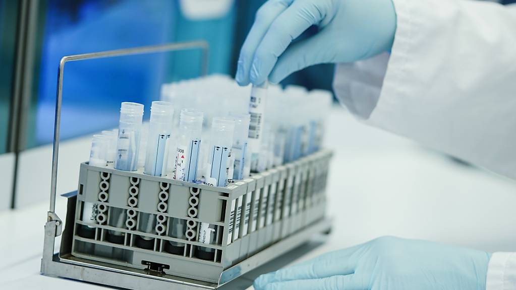 Ein Mitarbeiter hält in einem Coronatest-Labor PCR-Teströhrchen in den Händen. Foto: Uwe Anspach/dpa