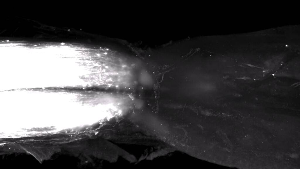 Die Nerven wachsen wieder über das Rückenmark.