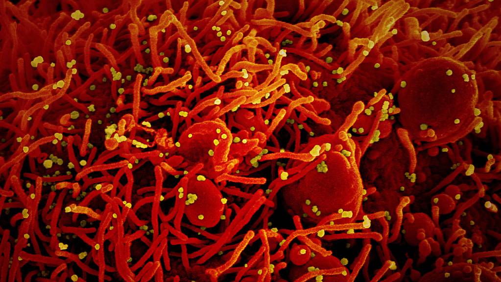 ARCHIV - Eine Zelle (rot) mit dem Coronavirus (SARS-CoV-2, gelb) infiziert. Foto: National Institute of Allergy and Infectious Diseases/Europa Press/dpa - ACHTUNG: Nur zur redaktionellen Verwendung und nur mit vollständiger Nennung des vorstehenden Credits