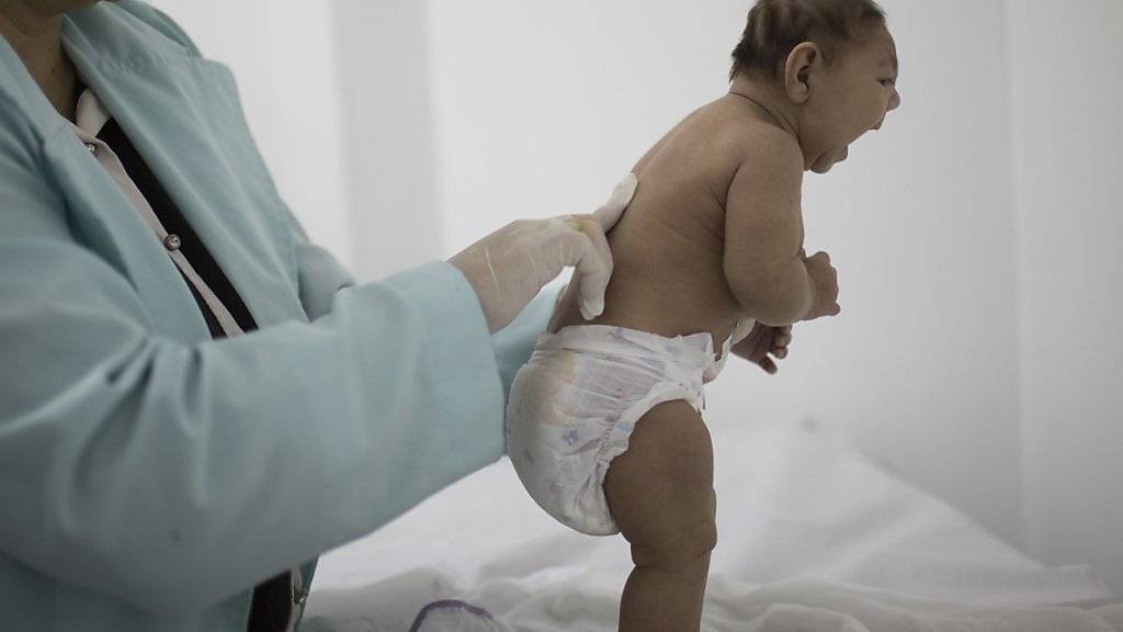 Forscher fanden Zika-Viren in Gehirnen von Neugeborenen: Eine Ärztin untersucht ein Mädchen in Brasilien, das mit einer Schädelfehlbildung geboren wurde. (Symbolbild)