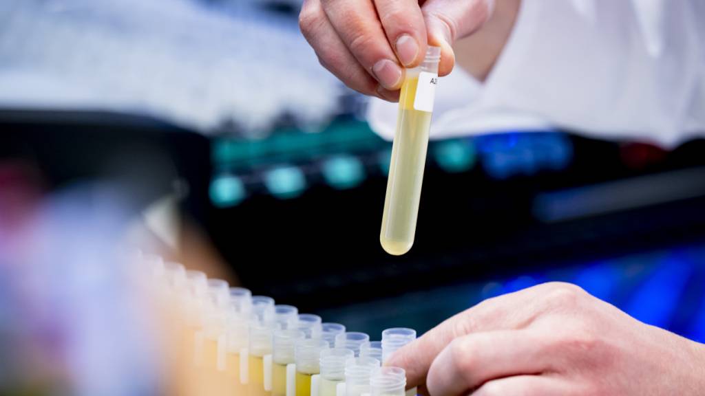 Grösster Fund illegaler Peptide in der Schweiz in Pratteln BL