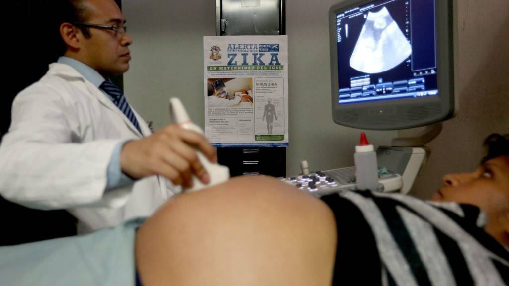 Schwangere sind gefährdet vom Zika-Virus.
