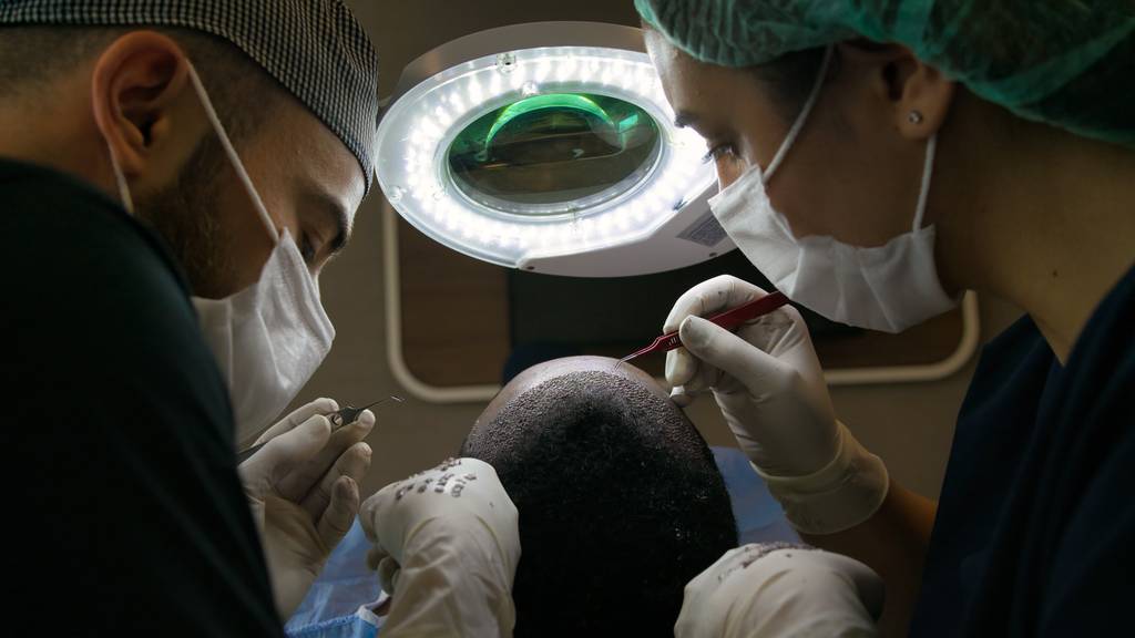 Haartransplantationen sind in der Schweiz immer beliebter. (Symbolbild)