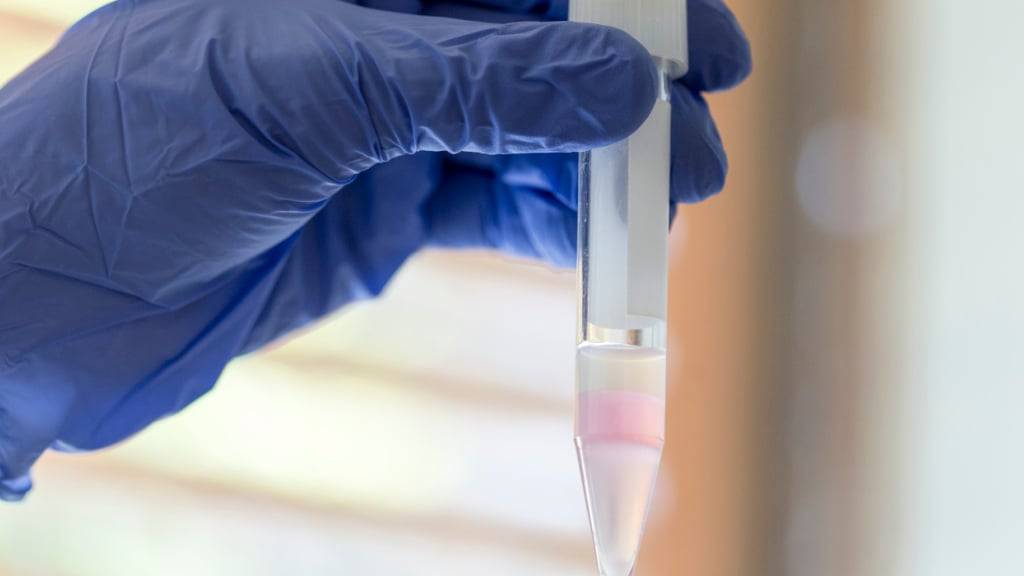 Die Spermienqualität in der Schweiz unterscheidet sich je nach Wohnort. (Archivbild)