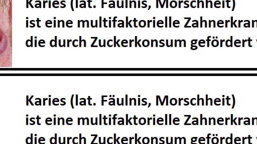 Warnhinweise und Schockbilder auf Süssigkeiten können einer Studie zufolge Konsumentinnen und Konsumenten dazu bewegen, weniger zuckerhaltige Produkte zu kaufen. (Archivbild)