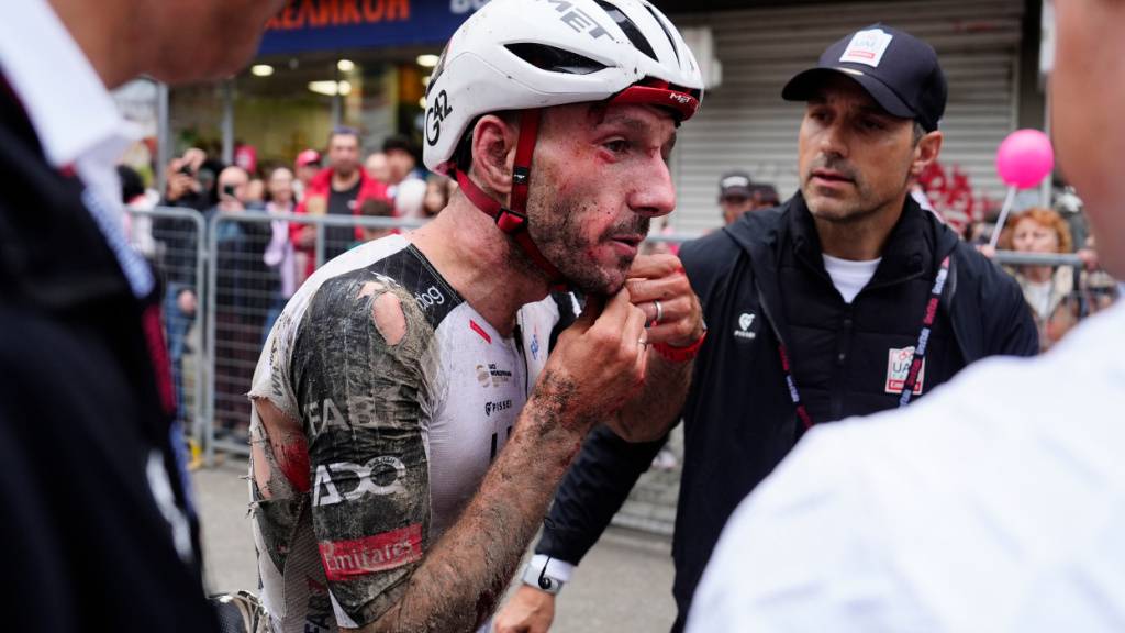 Gezeichnet vom schweren Sturz: Adam Yates im Ziel der 2. Etappe
