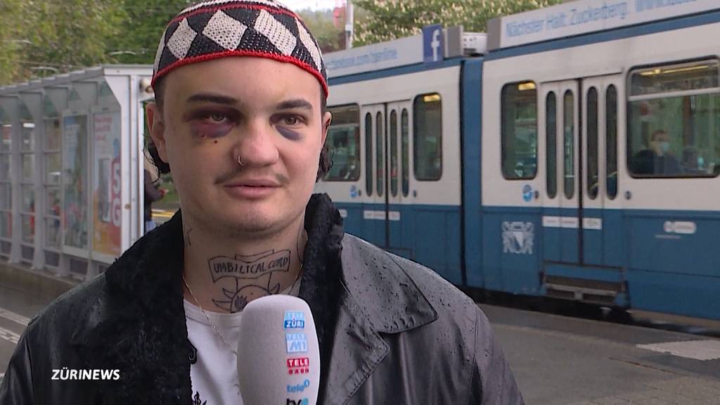 «Hatecrime» im 4er-Tram: 20-Jähriger brutal verprügelt