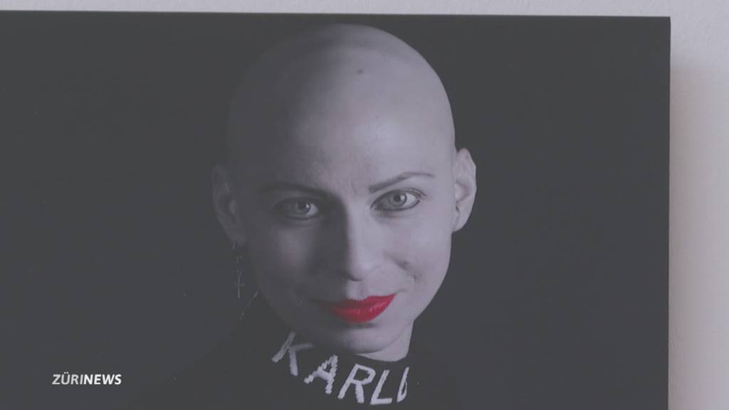 Krebskranke Frauen mit Glatze