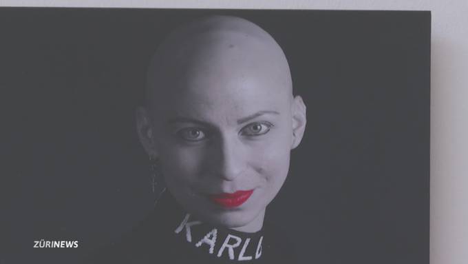 Krebskranke Frauen mit Glatze