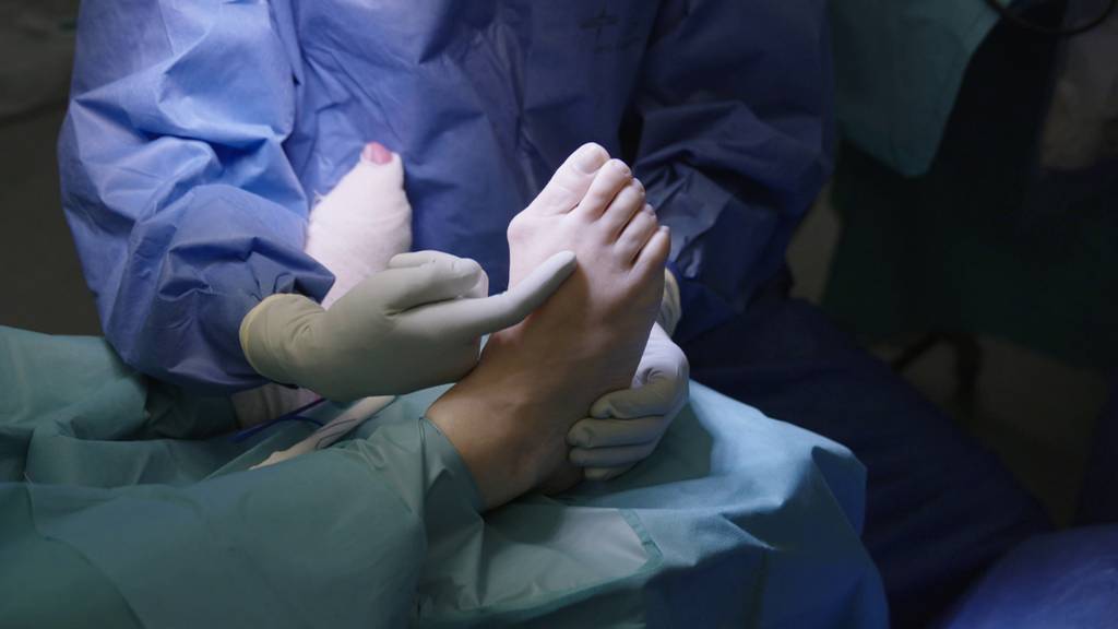 Hallux Valgus