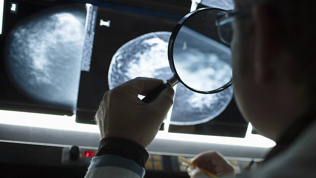 Früherkennung von Brustkrebs: Aargauer Programm wird konkret