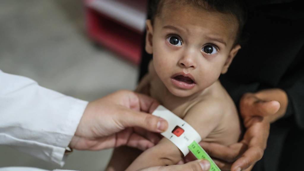 ARCHIV - Die Welthungerhilfe warnt vor einer Zunahme von Hungersnöten (im Bild: unterernährtes Kind in Syrien). Foto: Anas Alkharboutli/dpa