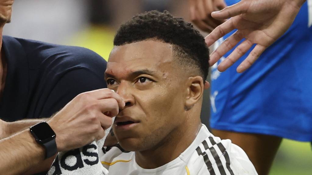 Kylian Mbappé wird in den nächsten Tagen von medizinischem Personal betreut werden