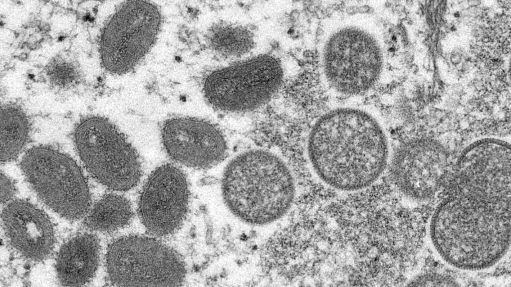 Diese elektronenmikroskopische Aufnahme aus dem Jahr 2003, die von den Centers for Disease Control and Prevention zur Verfügung gestellt wurde, zeigt reife, ovale Affenpockenviren (l) und kugelförmige unreife Virionen (r). 
