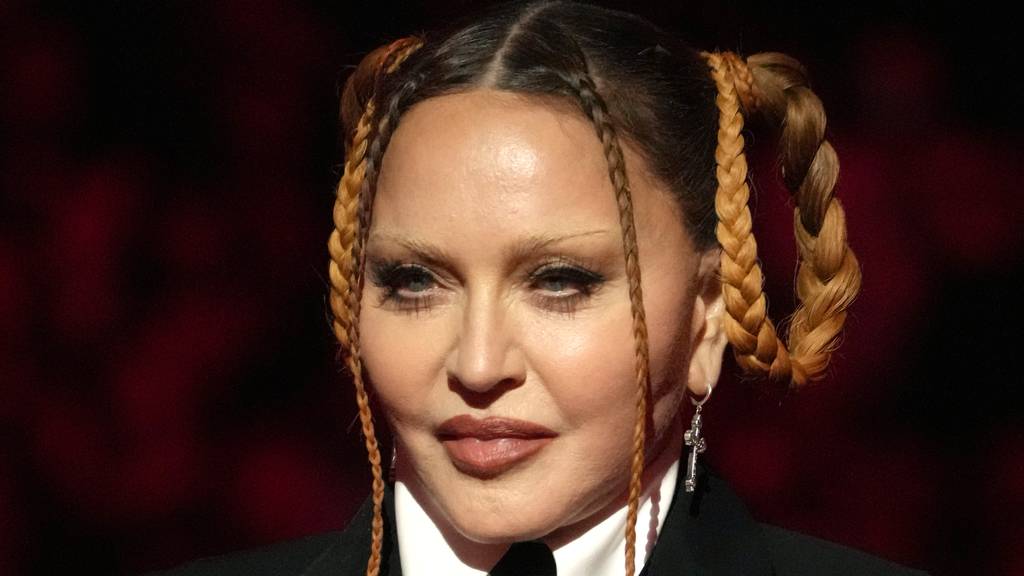 «Druck, jung auszusehen, ist riesig»: Madonnas «neues» Gesicht gibt zu reden